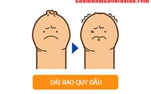 dài bao quy đầu giả có cần cắt không